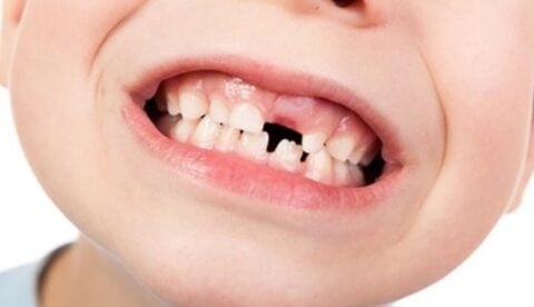 Dientes-de-leche-480x276