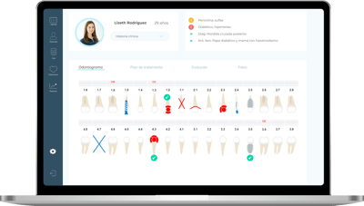Se muestra el odontograma de Doctocliq en una laptop
