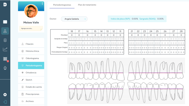 Imagen del periodontagrama en el software Doctocliq