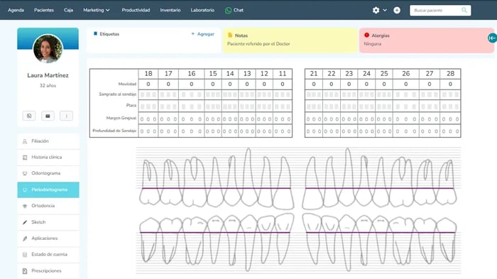 Periodontograma dental digital
