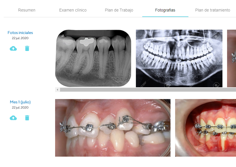 ortodoncia fotografias